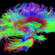Wiring diagram of the human brain, also known as the connectome. (Image: NIH/Laboratory of Neuro Imaging and Martinos Center for Biomedical Imaging, Consortium of the Human Connectome Project)